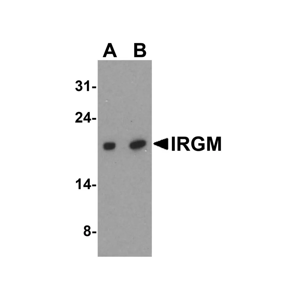 ProSci 4543_S IRGM Antibody, ProSci, 0.02 mg/Unit Primary Image