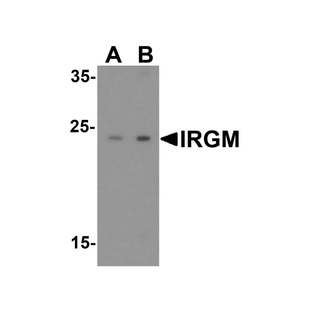 ProSci 4545 IRGM Antibody, ProSci, 0.1 mg/Unit Primary Image