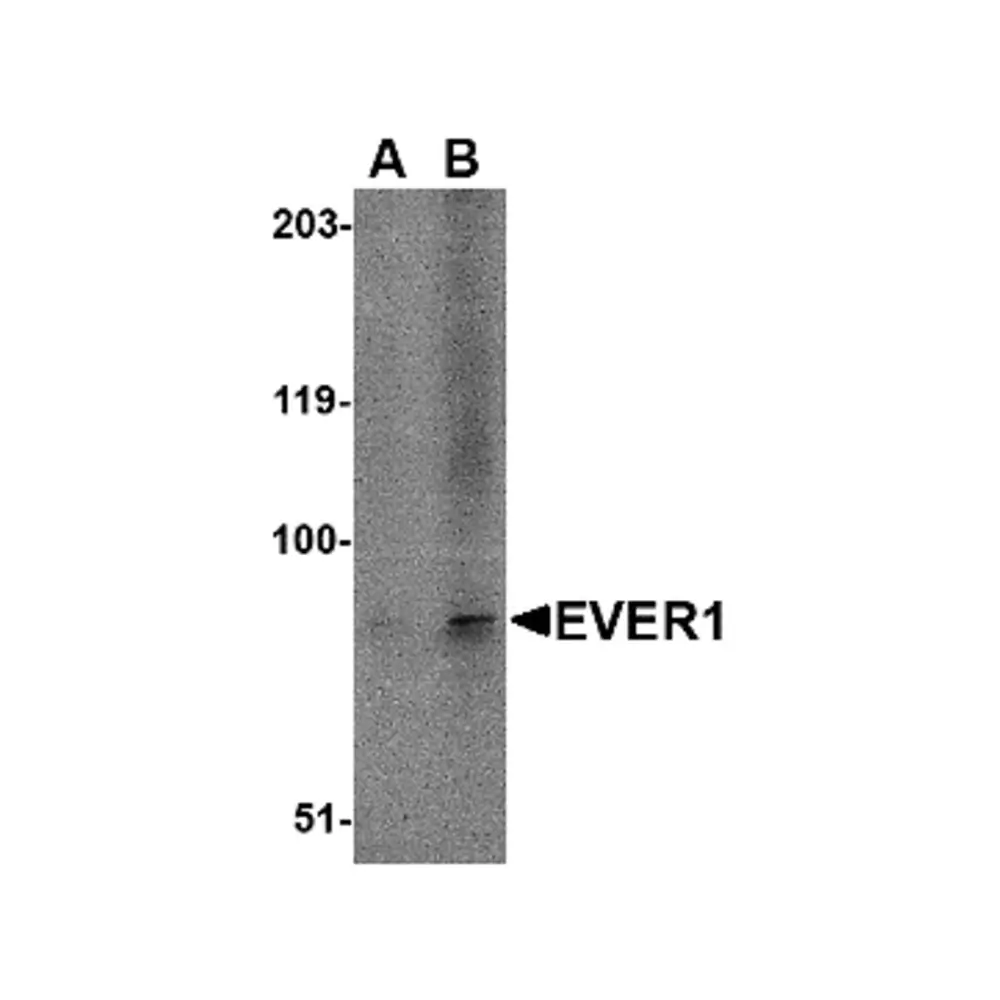 ProSci 4547 EVER1 Antibody, ProSci, 0.1 mg/Unit Primary Image
