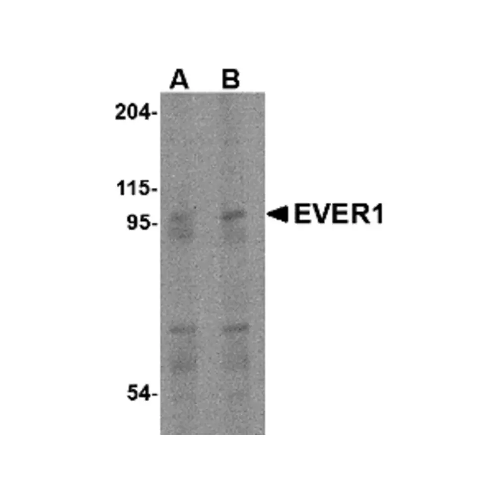 ProSci 4549 EVER1 Antibody, ProSci, 0.1 mg/Unit Primary Image