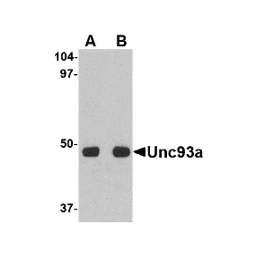 ProSci 4551 Unc93a Antibody, ProSci, 0.1 mg/Unit Primary Image