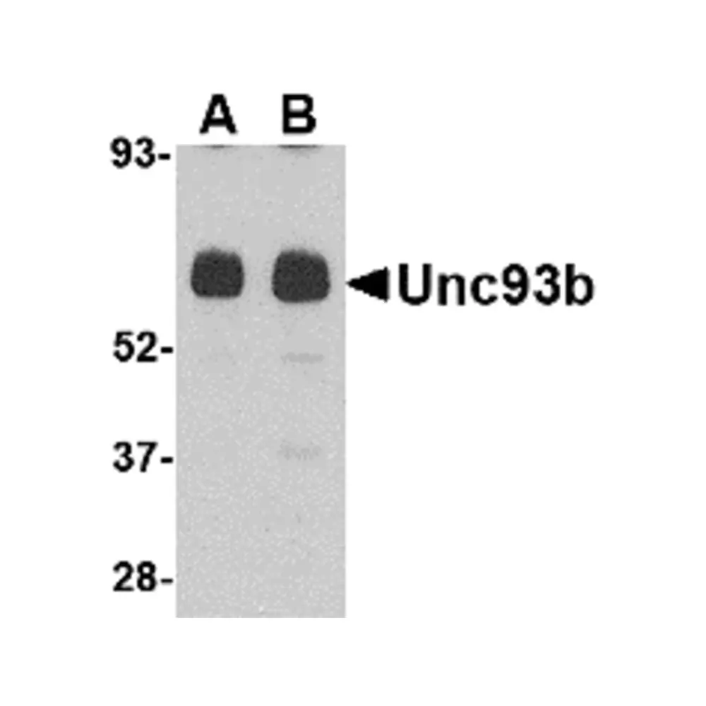 ProSci 4553 Unc93b Antibody, ProSci, 0.1 mg/Unit Primary Image