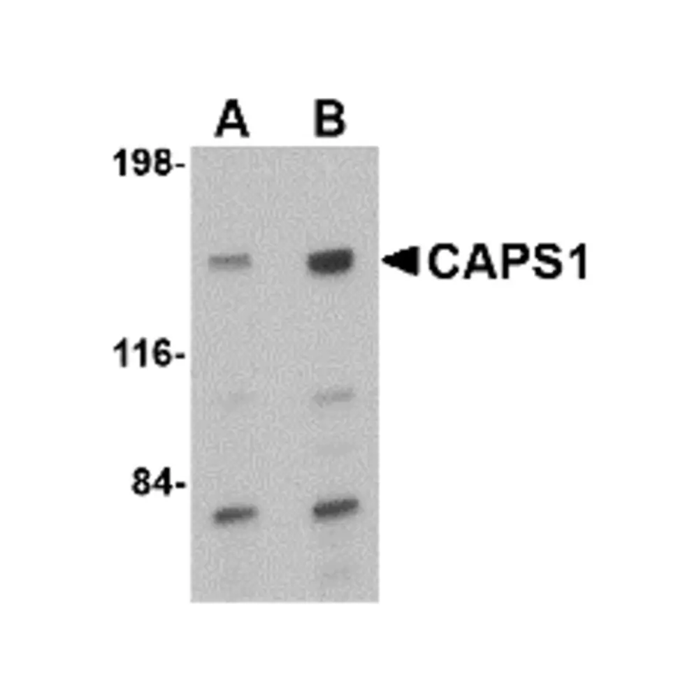 ProSci 4559 CAPS1 Antibody, ProSci, 0.1 mg/Unit Primary Image