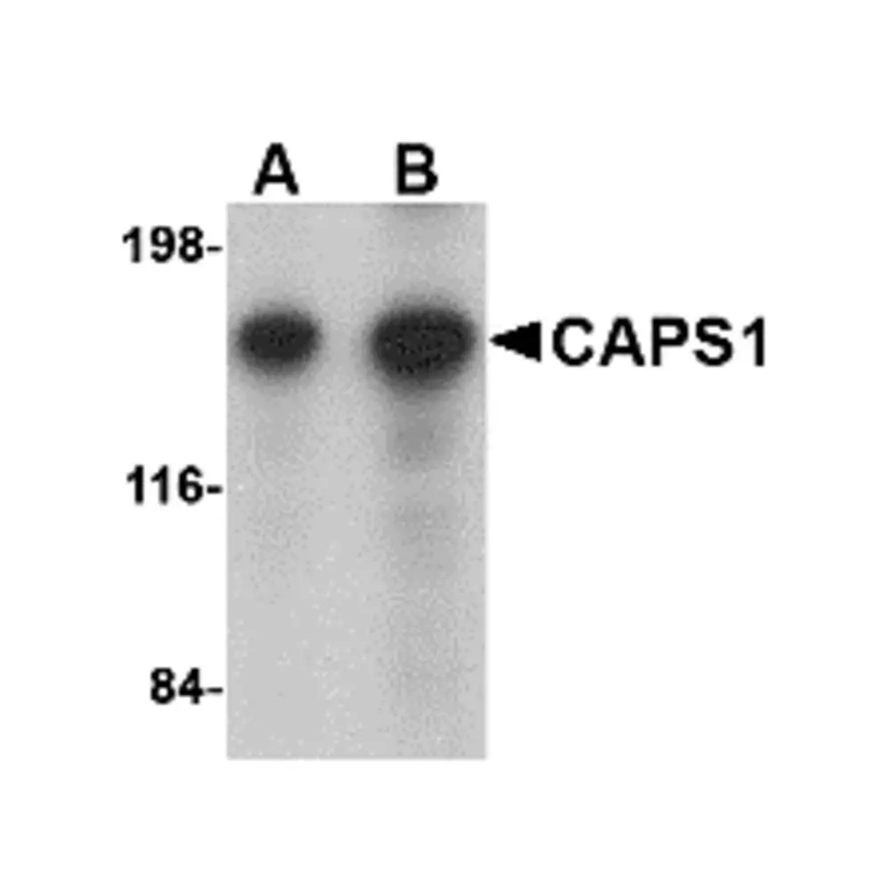 ProSci 4561 CAPS1 Antibody, ProSci, 0.1 mg/Unit Primary Image
