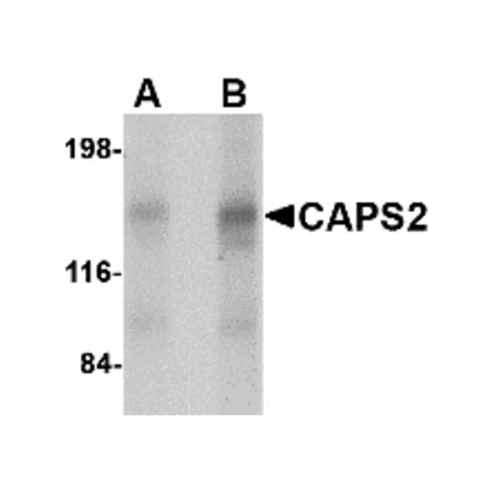 ProSci 4565 CAPS2 Antibody, ProSci, 0.1 mg/Unit Primary Image