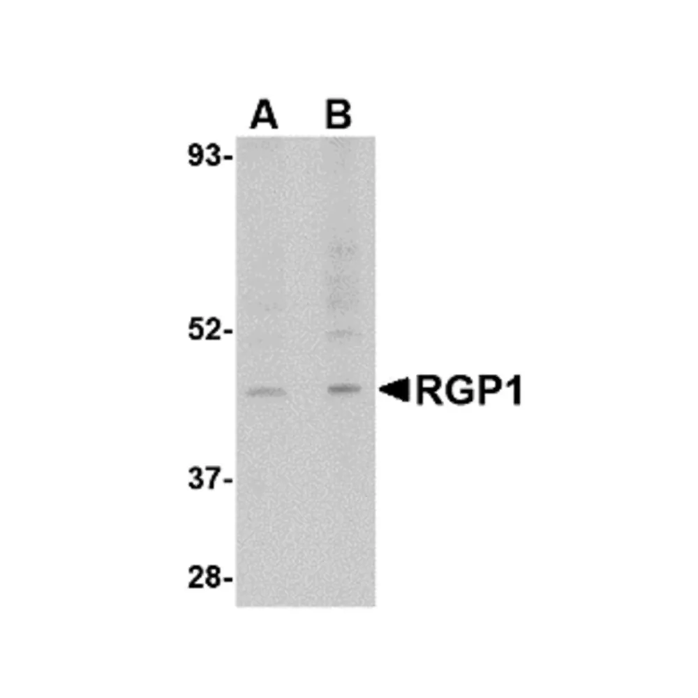 ProSci 4569 RGP1 Antibody, ProSci, 0.1 mg/Unit Primary Image