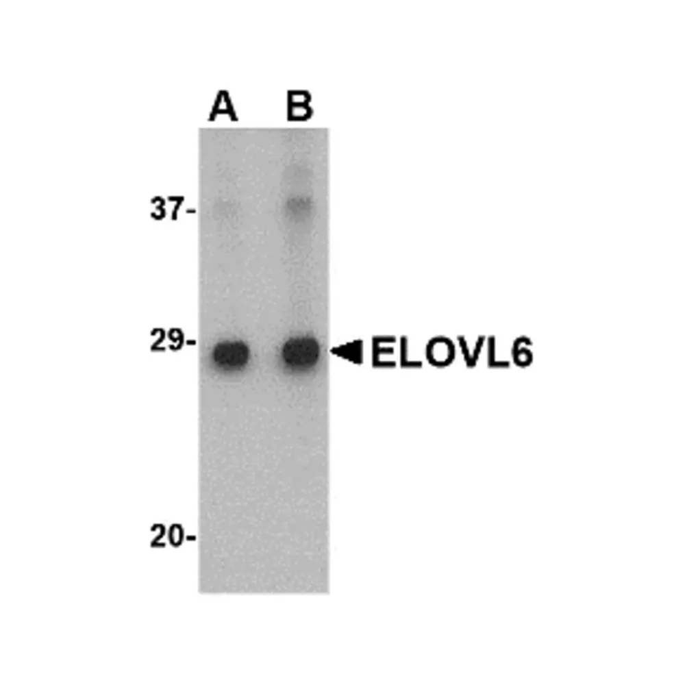 ProSci 4571 ELOVL6 Antibody, ProSci, 0.1 mg/Unit Primary Image