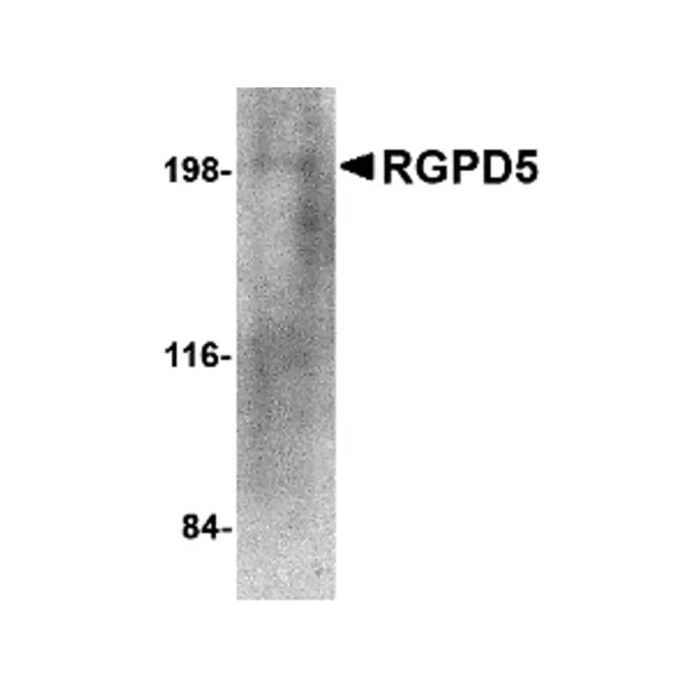ProSci 4585 RGPD5 Antibody, ProSci, 0.1 mg/Unit Primary Image
