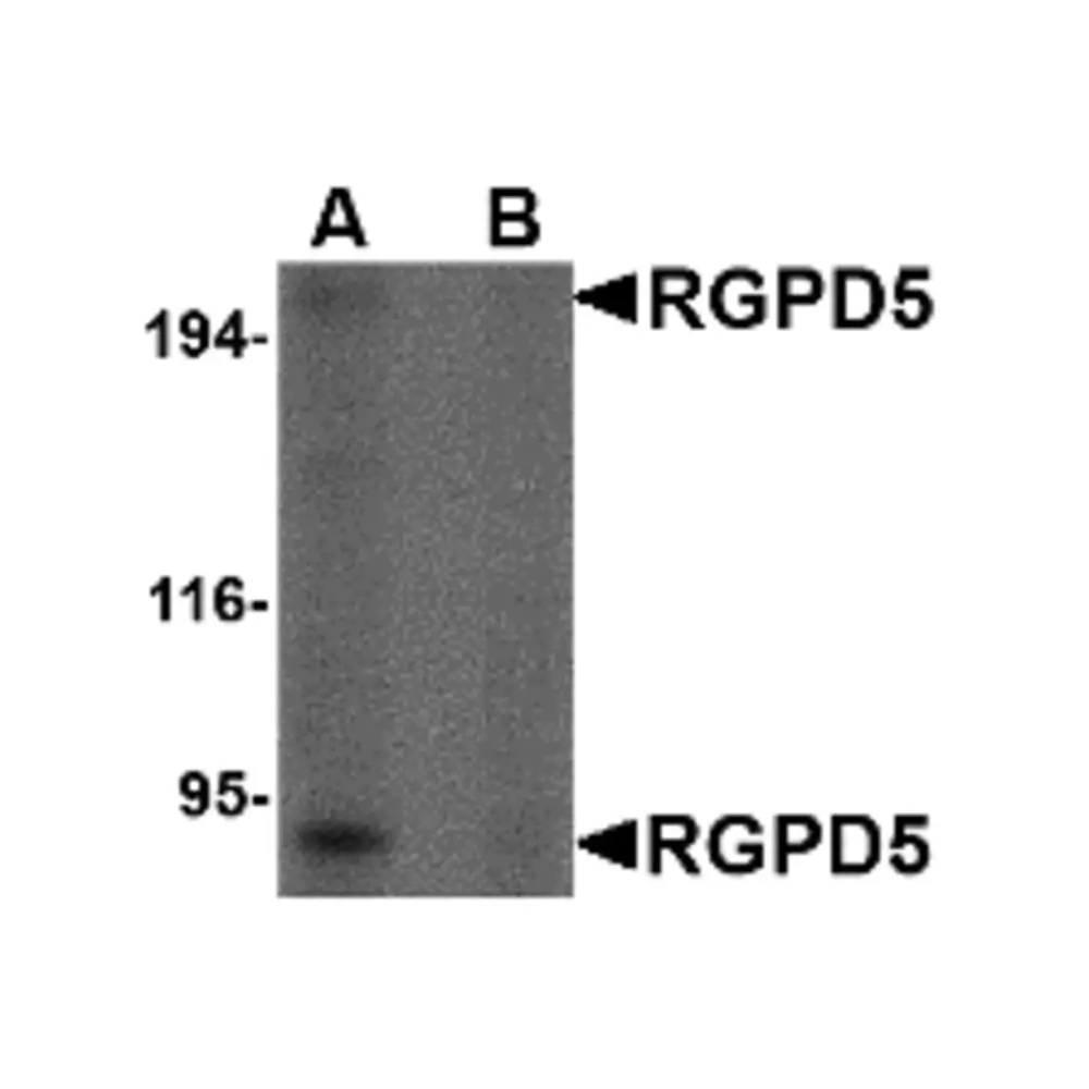 ProSci 4587 RGPD5 Antibody, ProSci, 0.1 mg/Unit Primary Image