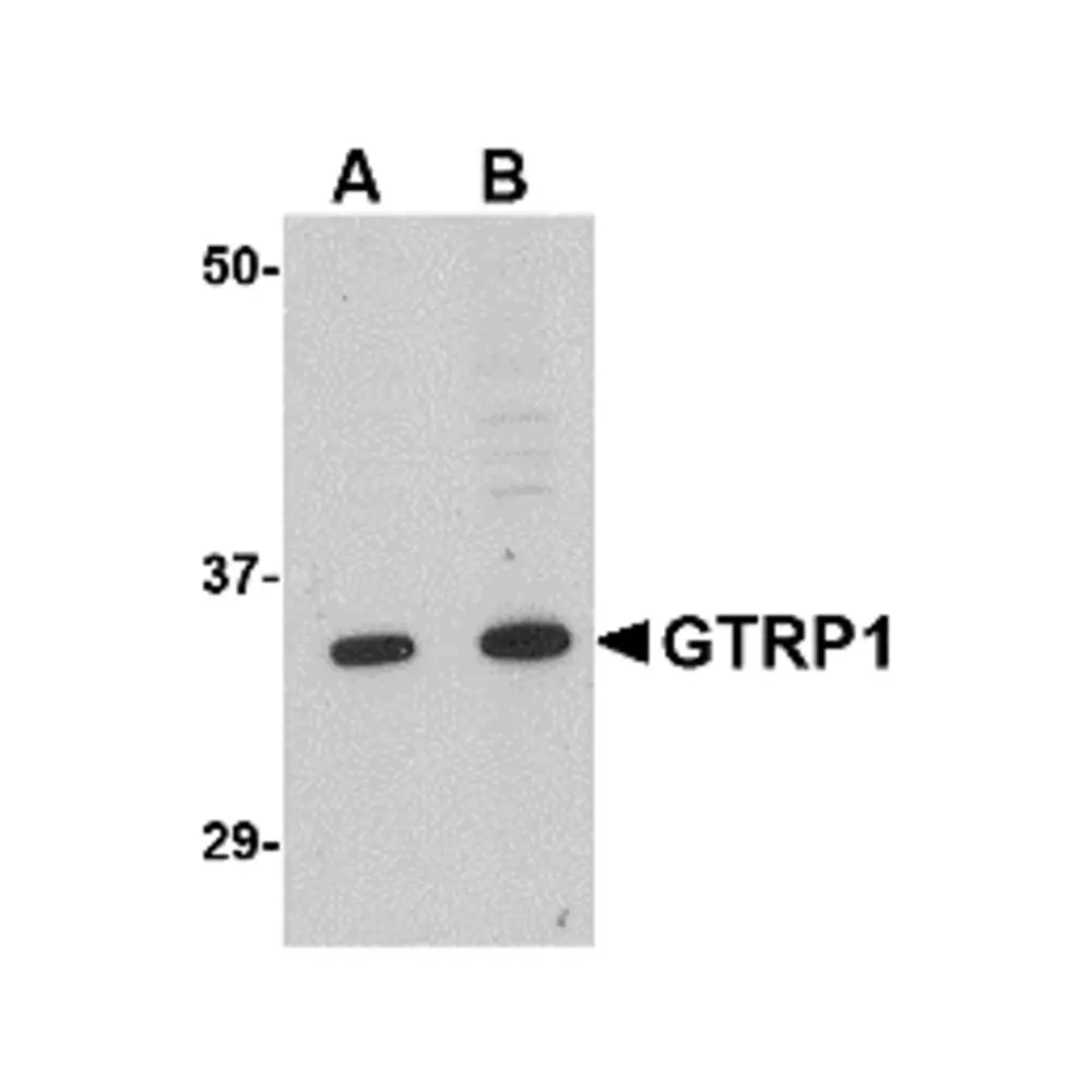 ProSci 4589_S GRTP1 Antibody, ProSci, 0.02 mg/Unit Primary Image
