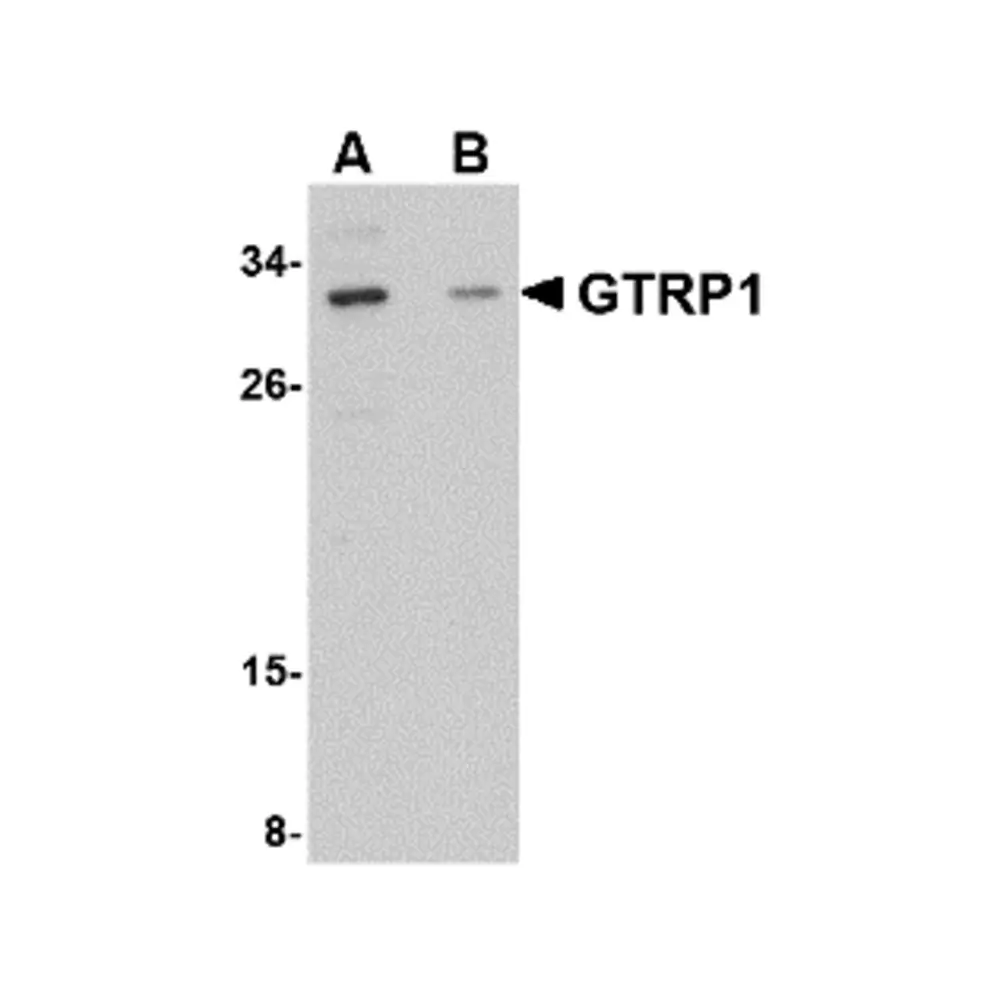 ProSci 4591 GRTP1 Antibody, ProSci, 0.1 mg/Unit Primary Image