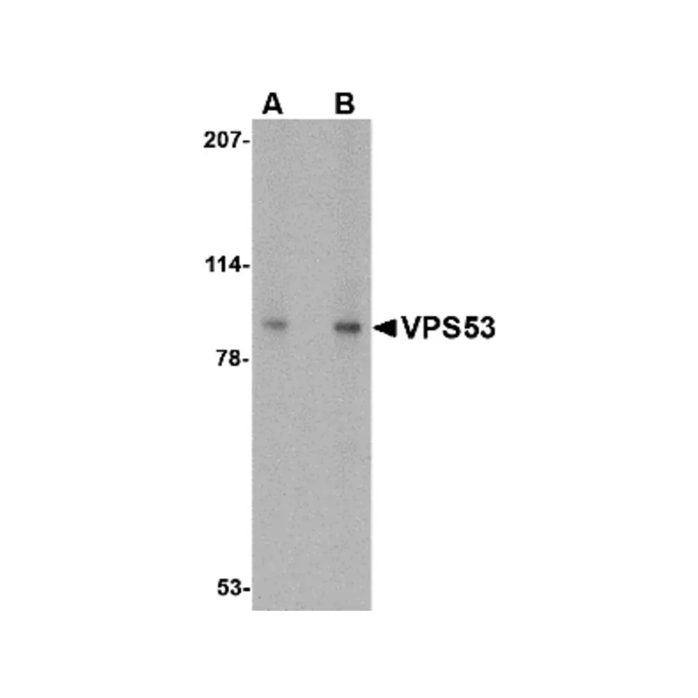 ProSci 4593_S VPS53 Antibody, ProSci, 0.02 mg/Unit Primary Image