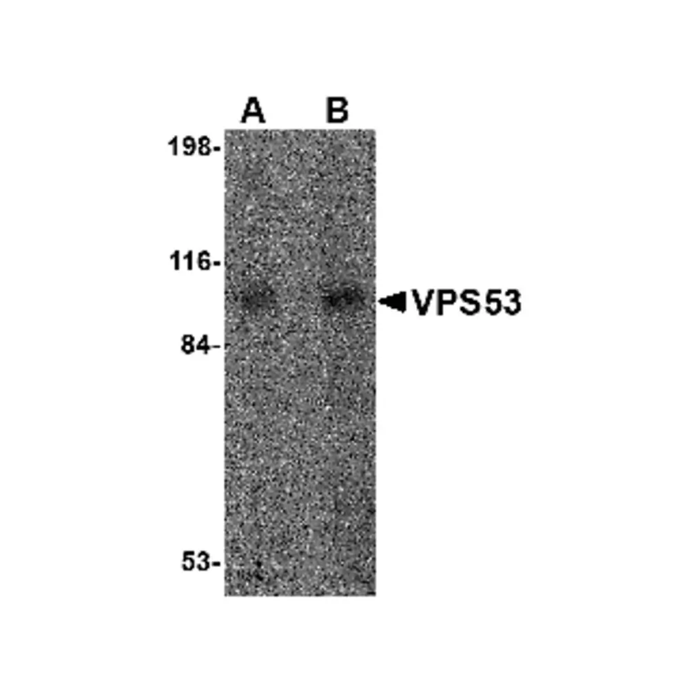 ProSci 4595 VPS53 Antibody, ProSci, 0.1 mg/Unit Primary Image