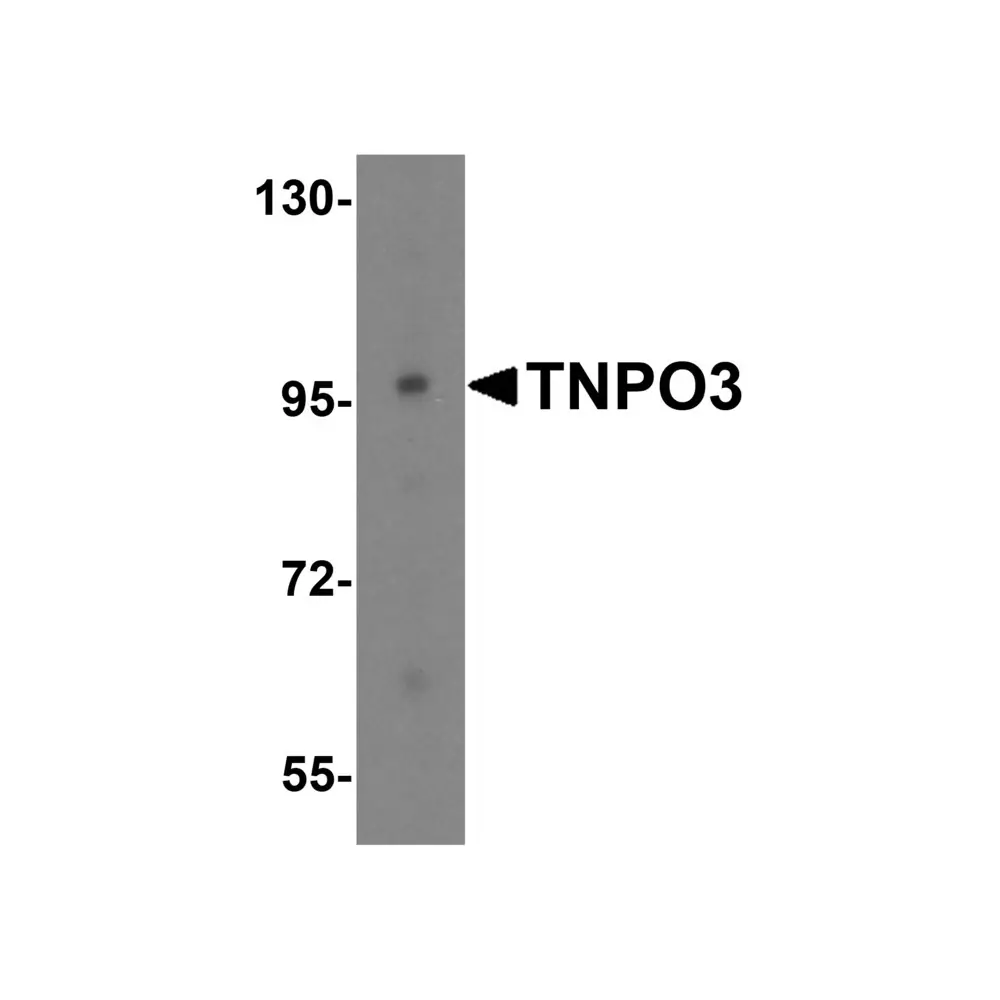 ProSci 4597_S TNPO3 Antibody, ProSci, 0.02 mg/Unit Primary Image