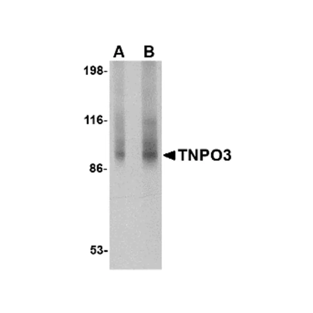 ProSci 4599 TNPO3 Antibody, ProSci, 0.1 mg/Unit Primary Image