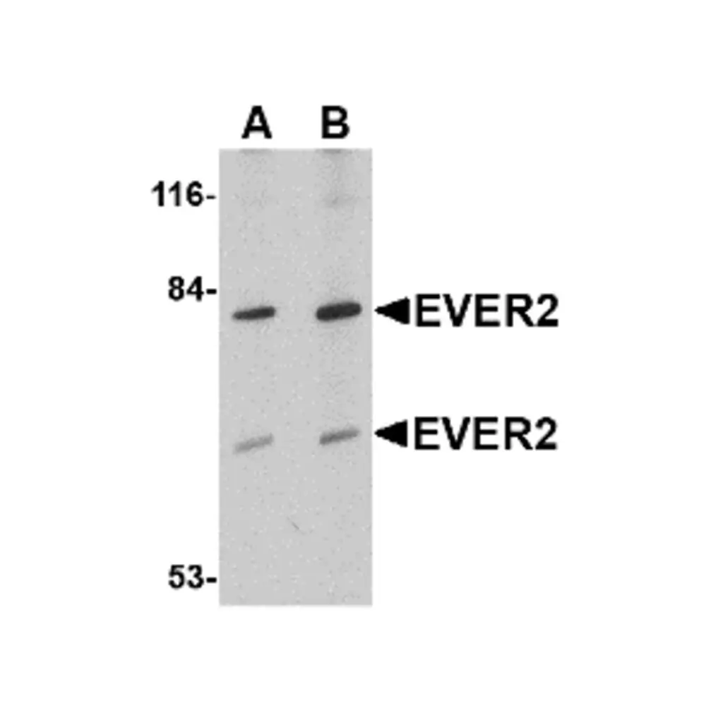 ProSci 4605 EVER2 Antibody, ProSci, 0.1 mg/Unit Primary Image