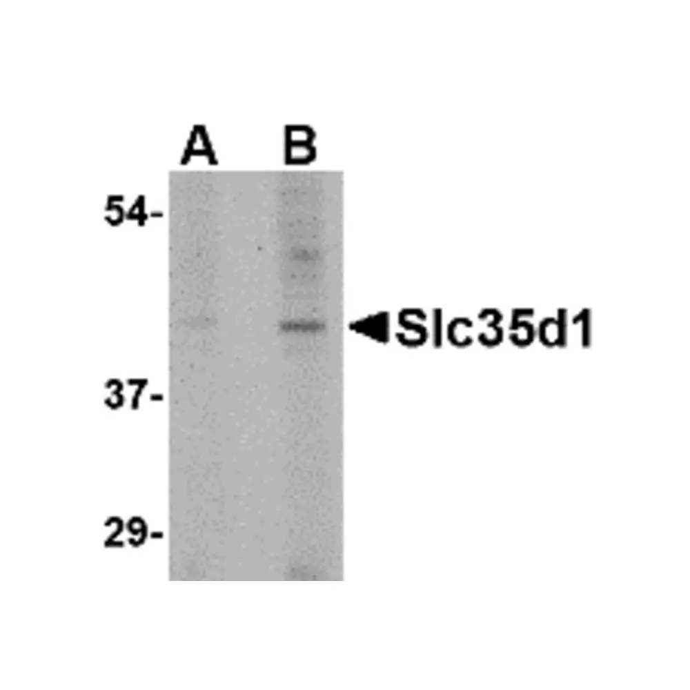 ProSci 4607_S Slc35D1 Antibody, ProSci, 0.02 mg/Unit Primary Image