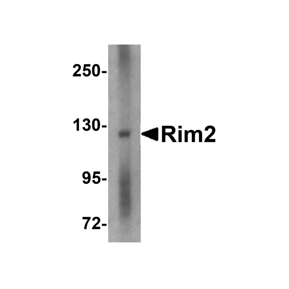 ProSci 4609 Rim2 Antibody, ProSci, 0.1 mg/Unit Primary Image