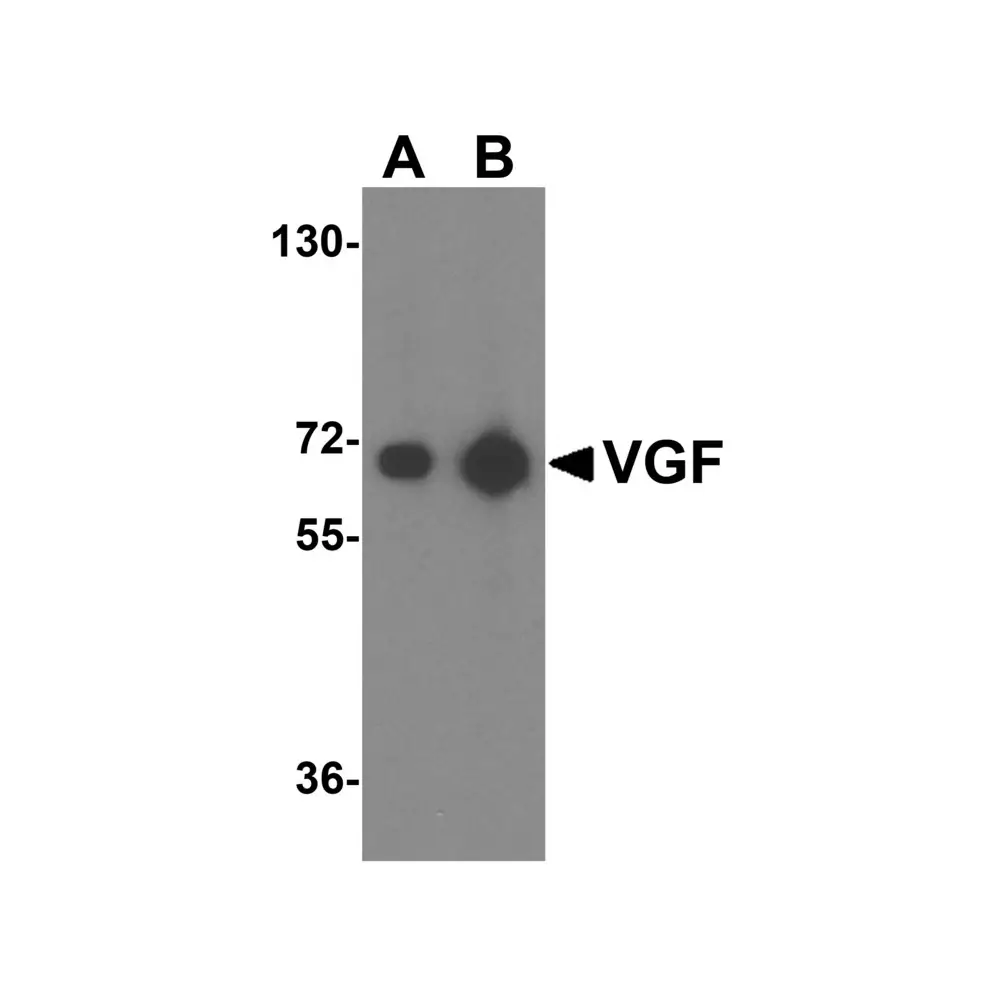 ProSci 4611_S VGF Antibody, ProSci, 0.02 mg/Unit Primary Image