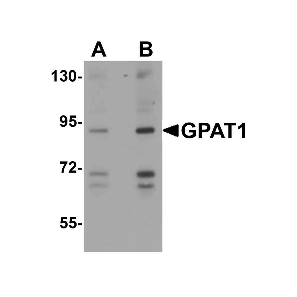 ProSci 4613 GPAT1 Antibody, ProSci, 0.1 mg/Unit Primary Image