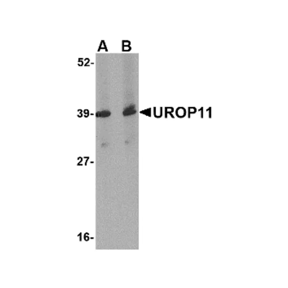 ProSci 4615_S UROP11 Antibody, ProSci, 0.02 mg/Unit Primary Image