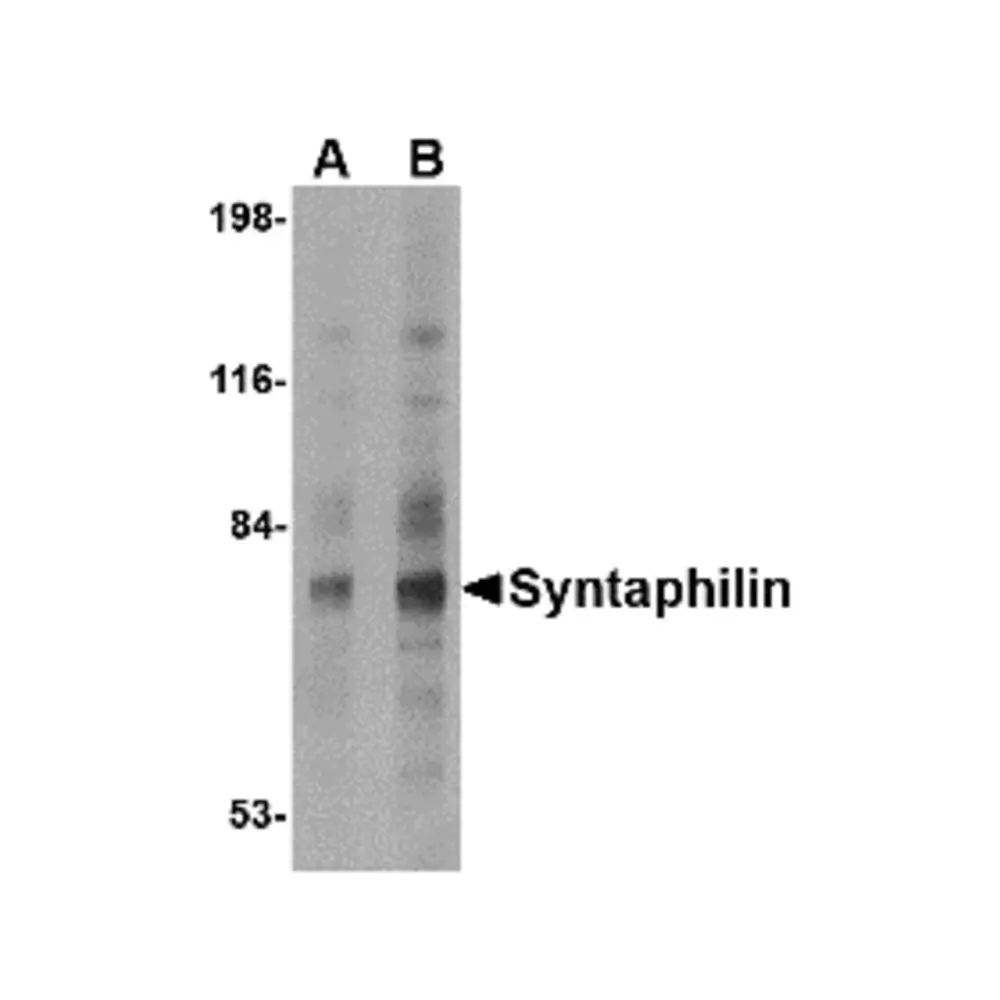 ProSci 4617 Syntaphilin Antibody, ProSci, 0.1 mg/Unit Primary Image