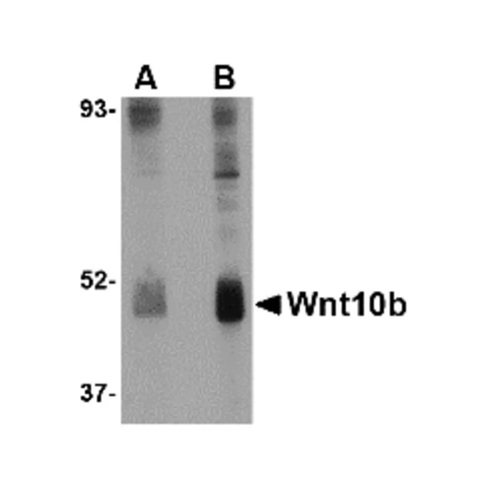 ProSci 4619_S Wnt10b Antibody, ProSci, 0.02 mg/Unit Primary Image