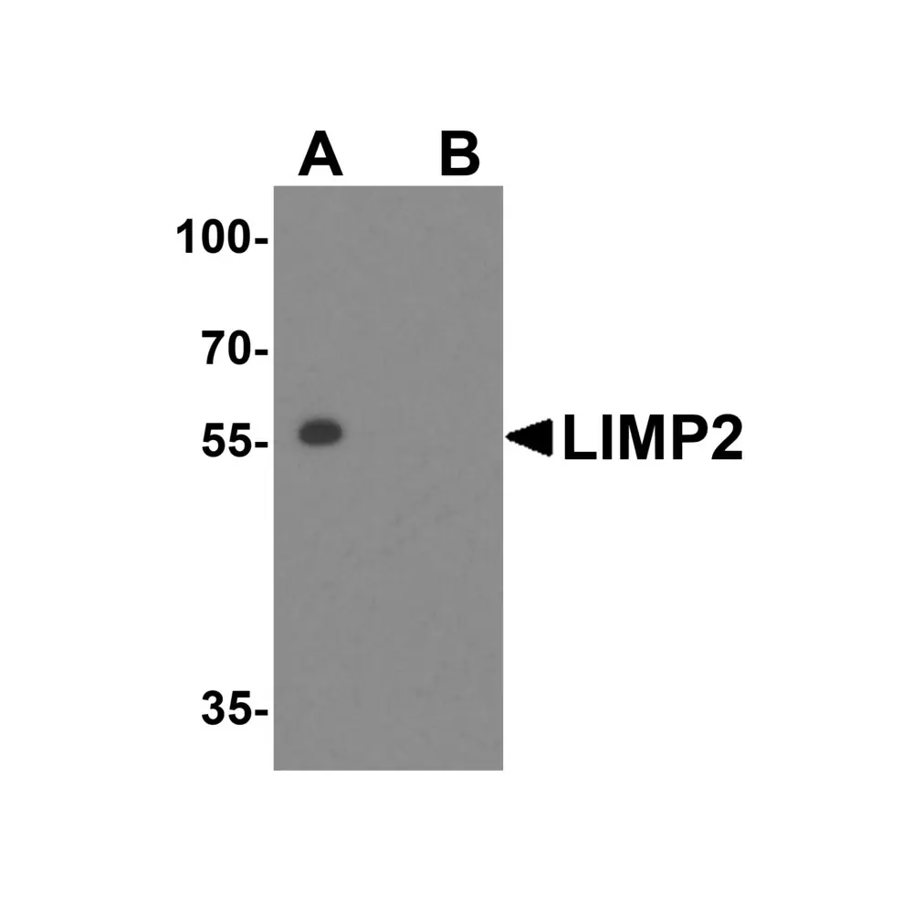 ProSci 4621 LIMP2 Antibody, ProSci, 0.1 mg/Unit Primary Image
