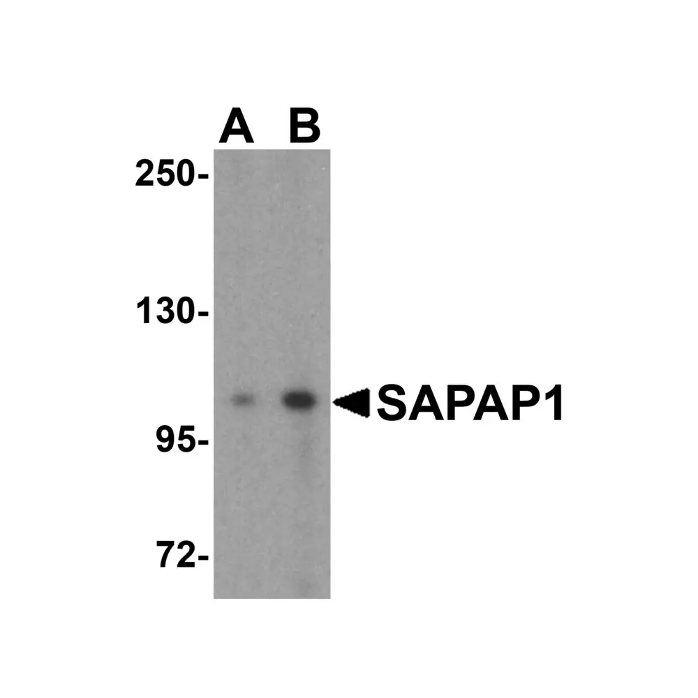ProSci 4623_S SAPAP1 Antibody, ProSci, 0.02 mg/Unit Primary Image