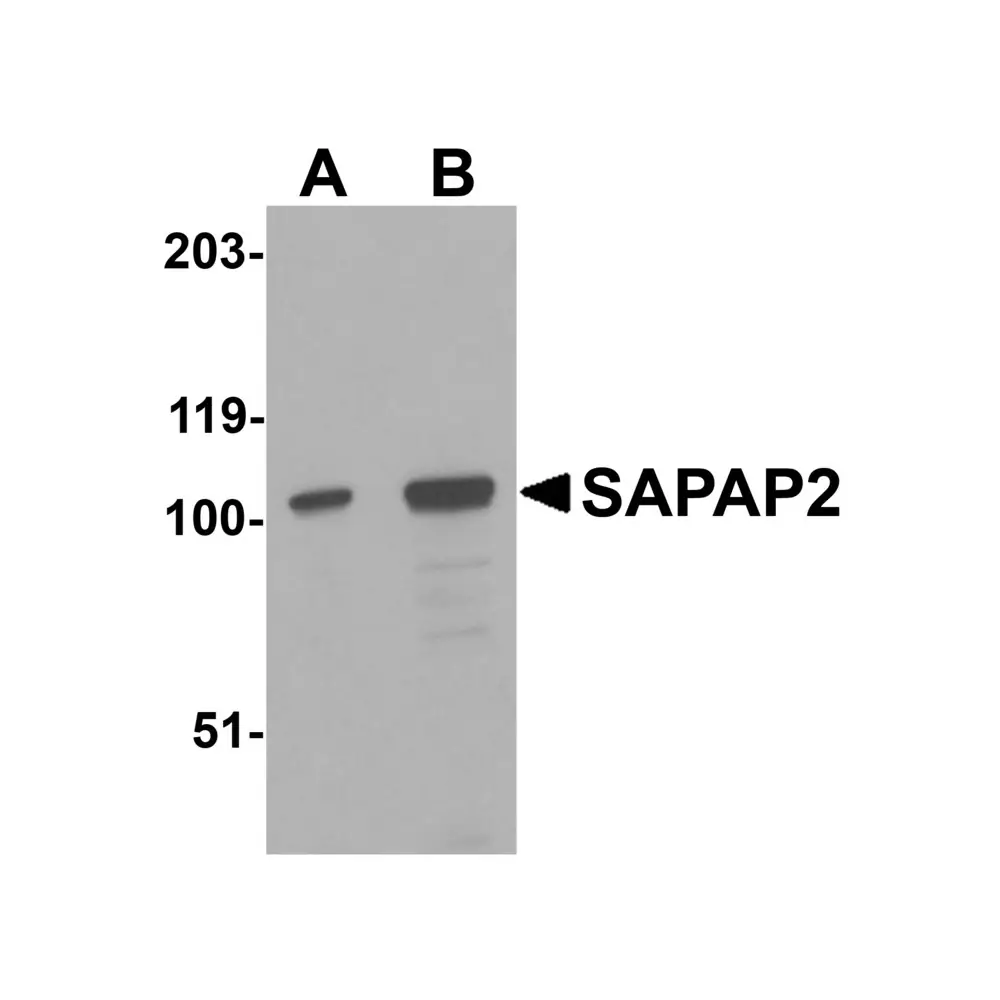 ProSci 4625 SAPAP2 Antibody, ProSci, 0.1 mg/Unit Primary Image