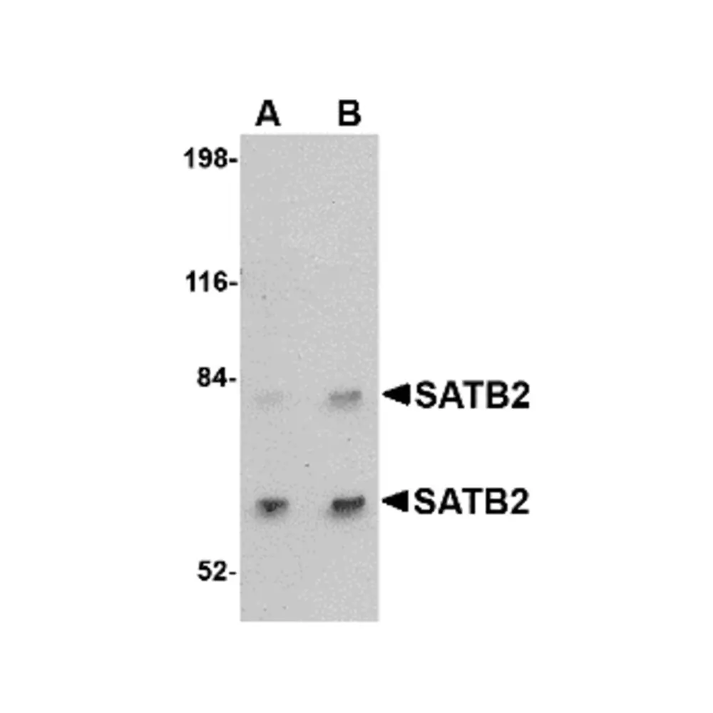 ProSci 4629 SATB2 Antibody, ProSci, 0.1 mg/Unit Primary Image