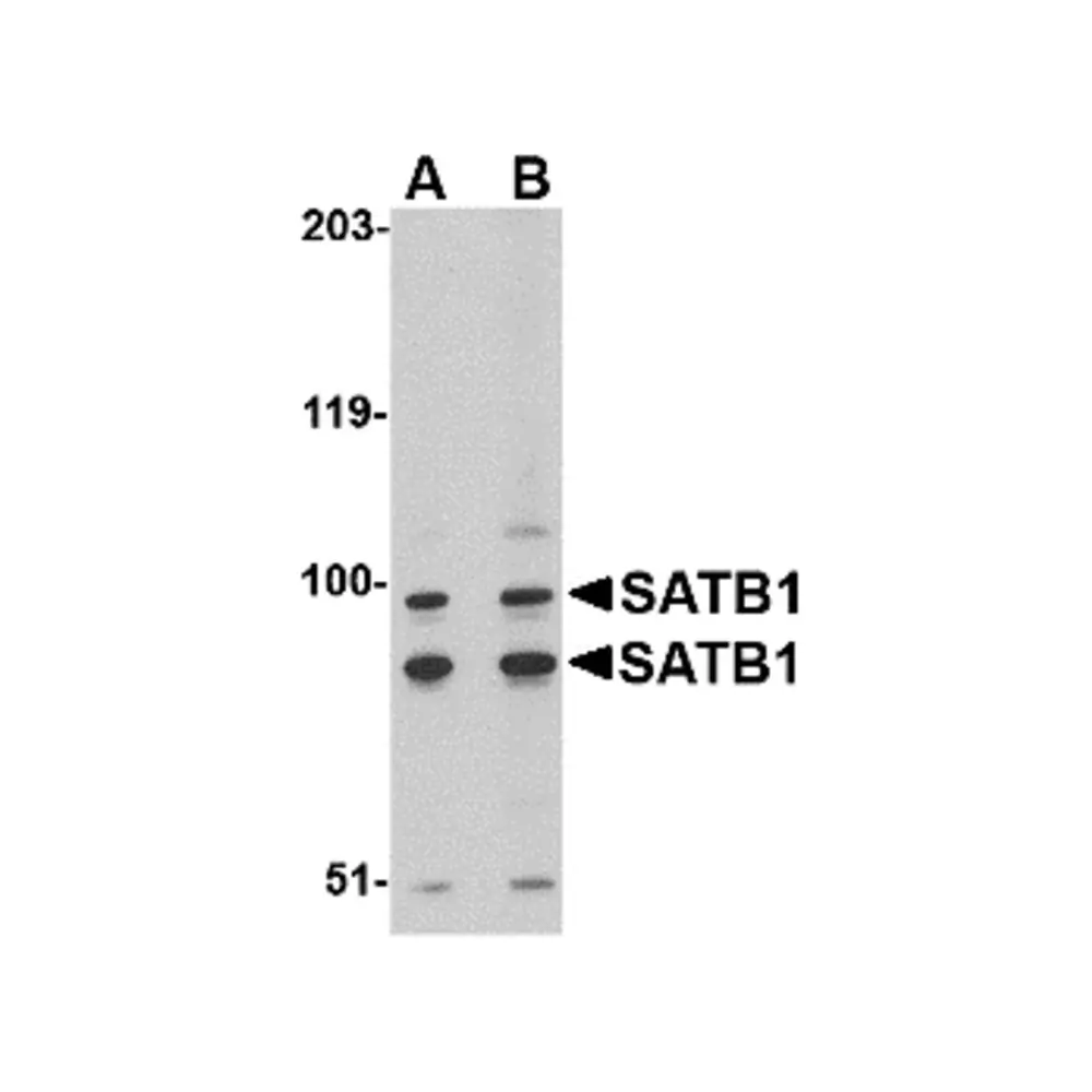 ProSci 4631 SATB1 Antibody, ProSci, 0.1 mg/Unit Primary Image