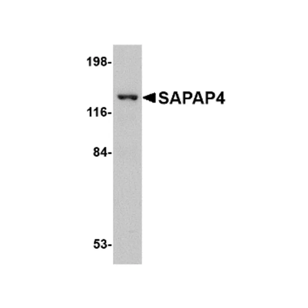 ProSci 4633 SAPAP4 Antibody, ProSci, 0.1 mg/Unit Primary Image
