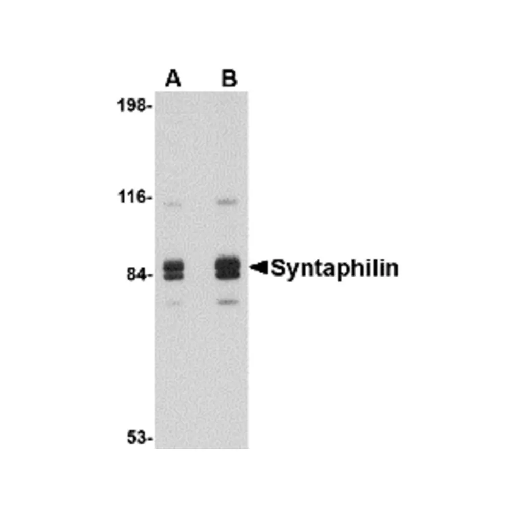 ProSci 4635_S Syntaphilin Antibody, ProSci, 0.02 mg/Unit Primary Image
