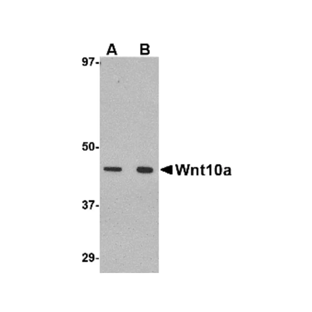 ProSci 4639_S Wnt10a Antibody, ProSci, 0.02 mg/Unit Primary Image