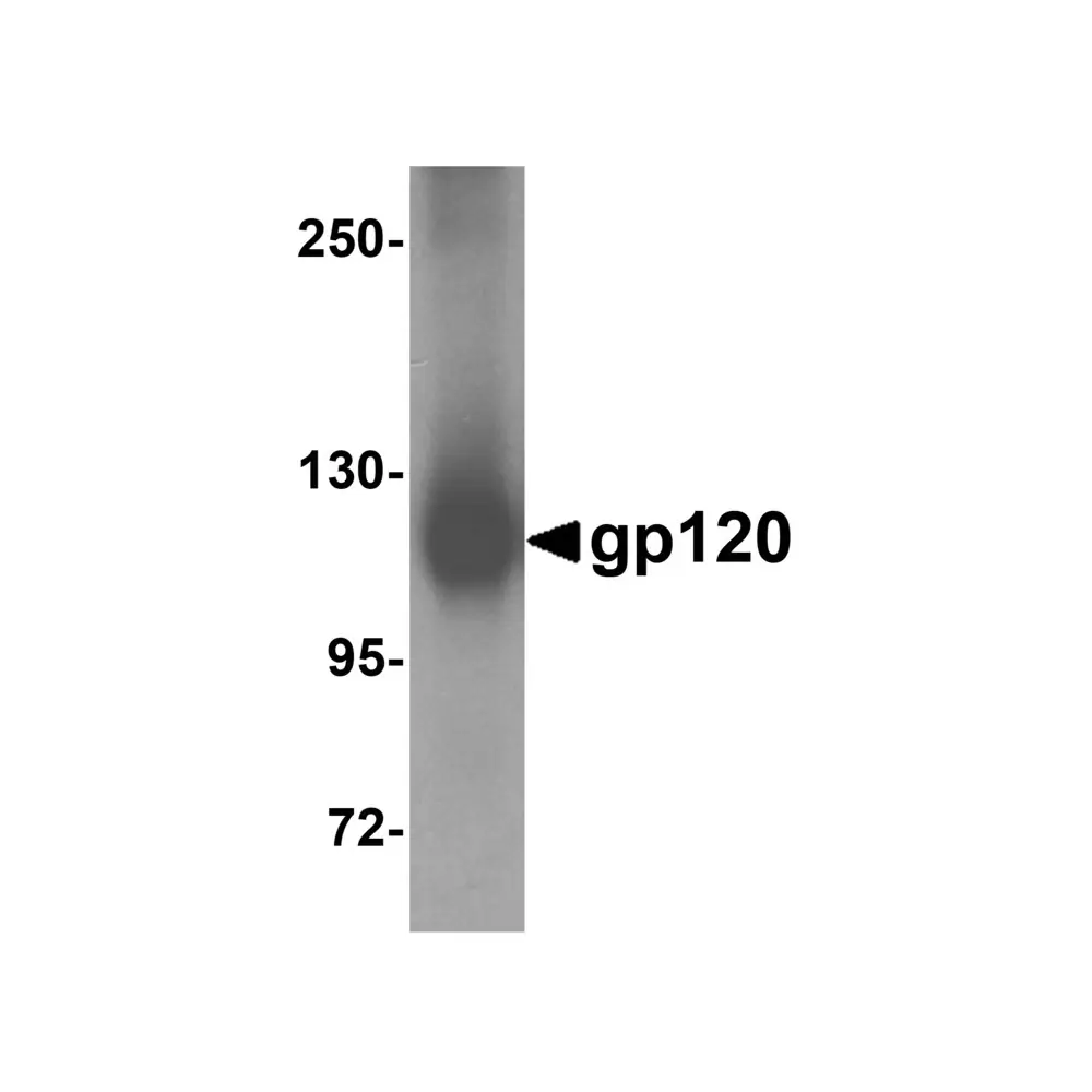 ProSci 4641 gp120 Antibody, ProSci, 0.1 mg/Unit Primary Image