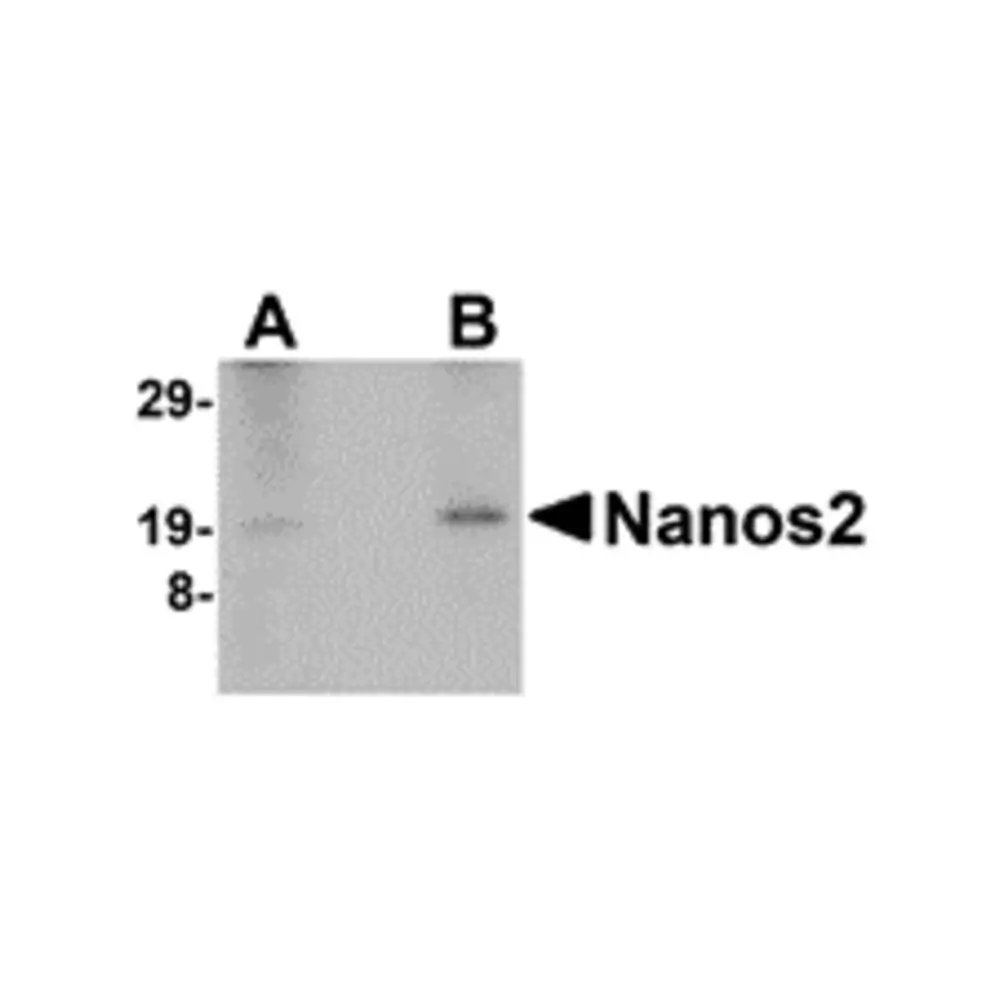 ProSci 4645 Nanos2 Antibody, ProSci, 0.1 mg/Unit Primary Image