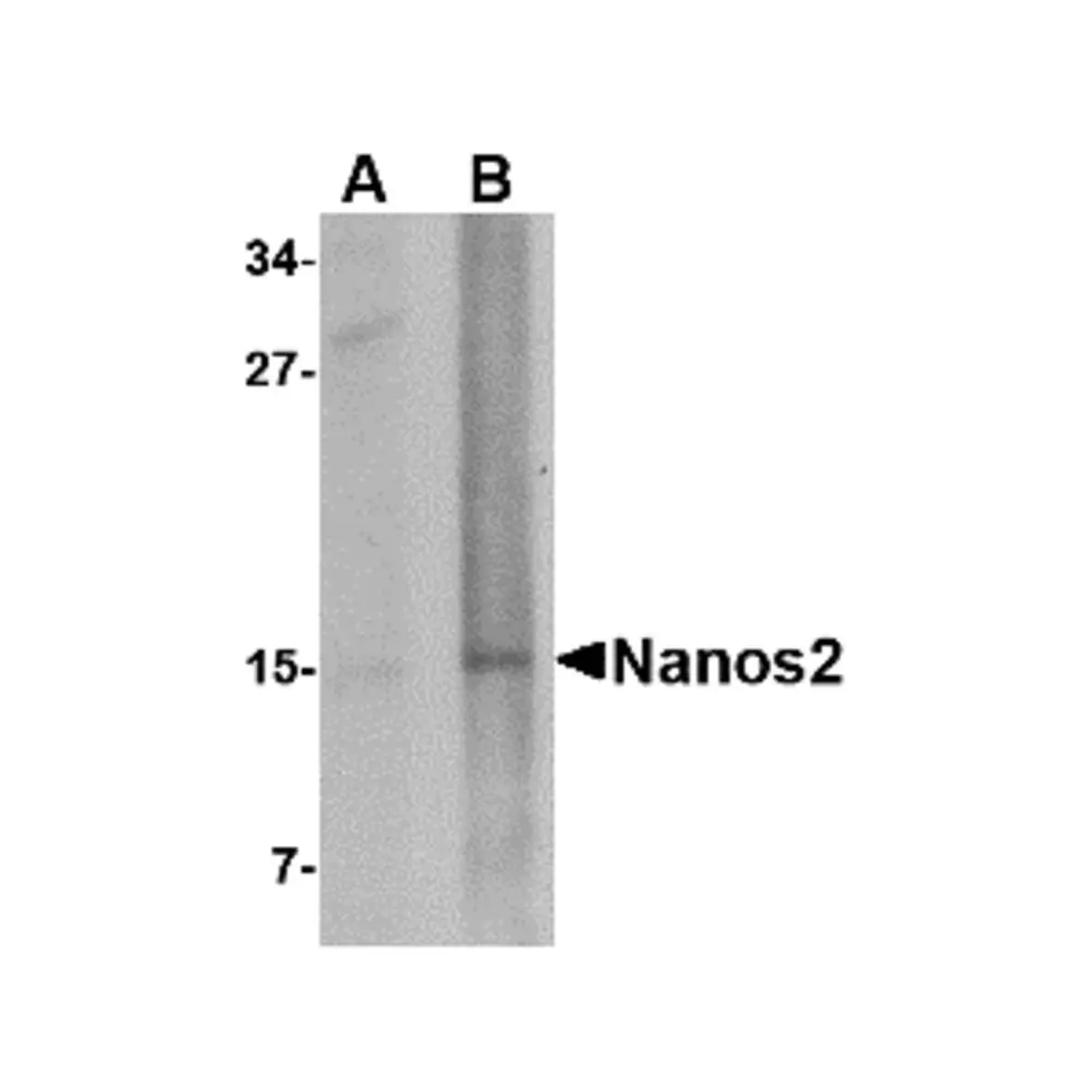 ProSci 4647_S Nanos2 Antibody, ProSci, 0.02 mg/Unit Primary Image