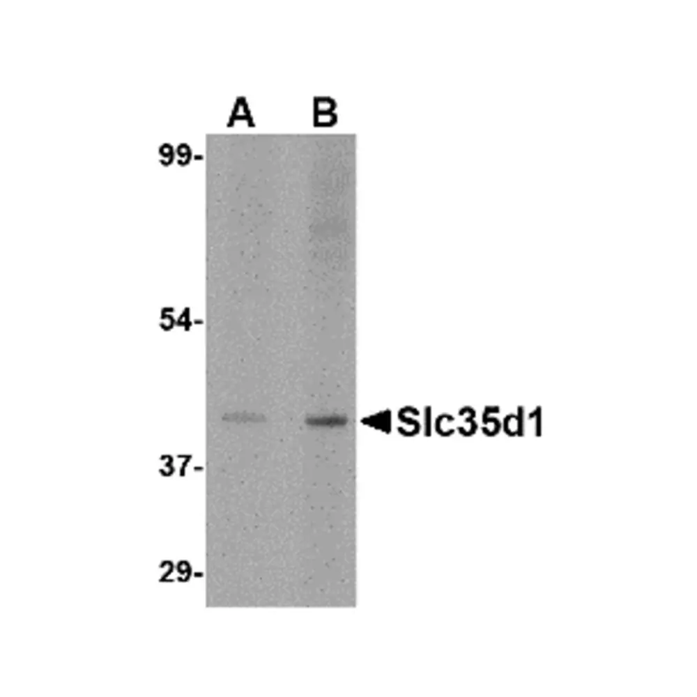 ProSci 4649 Slc35D1 Antibody, ProSci, 0.1 mg/Unit Primary Image