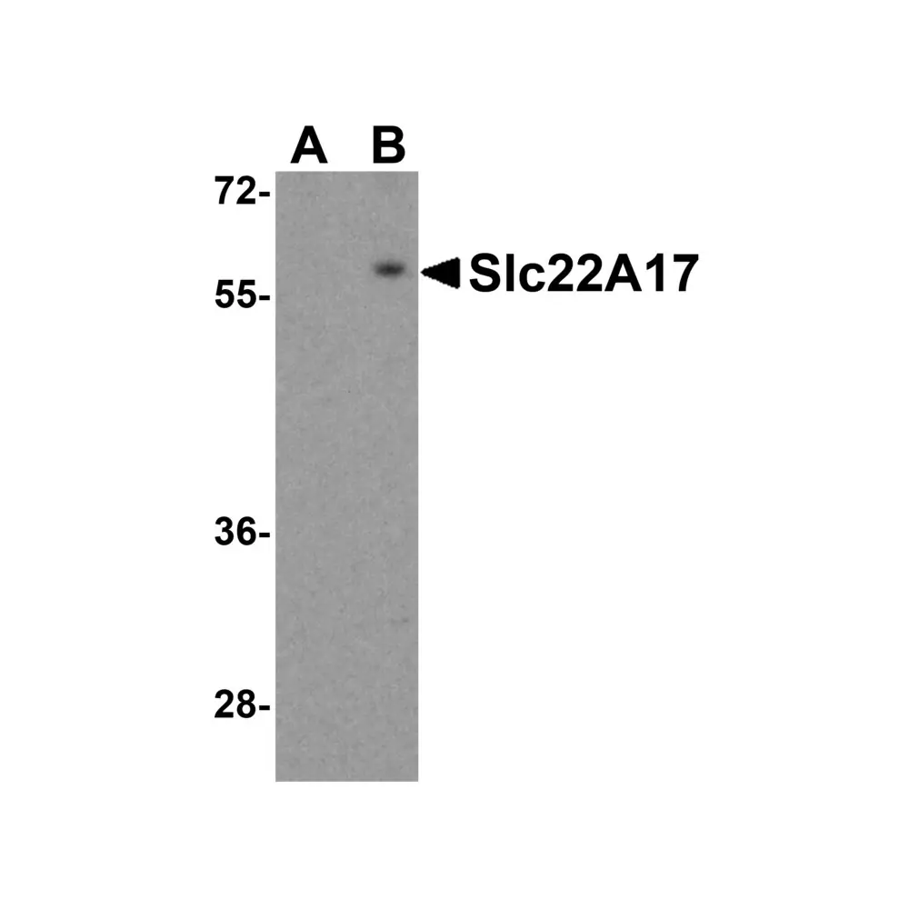 ProSci 4651 Slc22A17 Antibody, ProSci, 0.1 mg/Unit Primary Image
