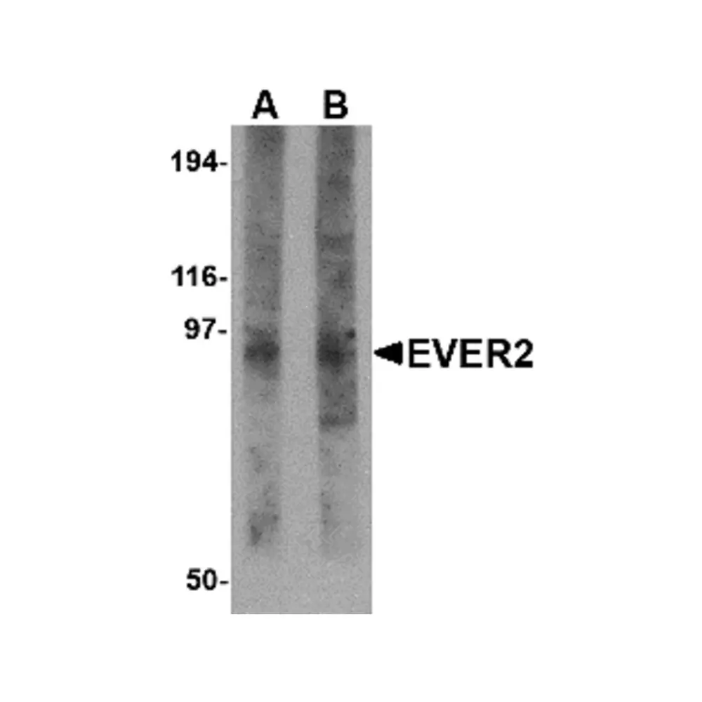 ProSci 4657 EVER2 Antibody, ProSci, 0.1 mg/Unit Primary Image