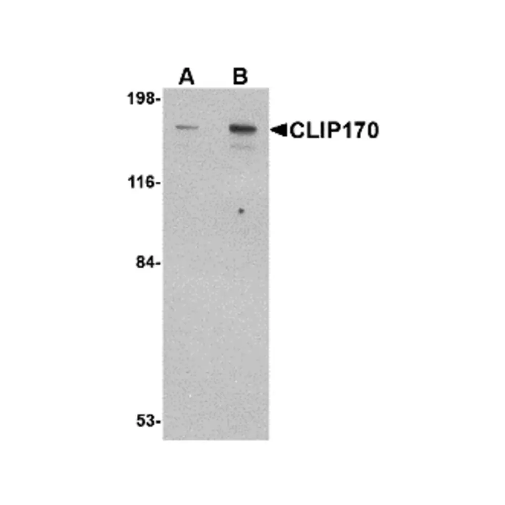 ProSci 4659 CLIP170 Antibody, ProSci, 0.1 mg/Unit Primary Image