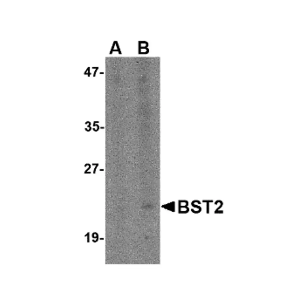 ProSci 4661 Bst2 Antibody, ProSci, 0.1 mg/Unit Primary Image