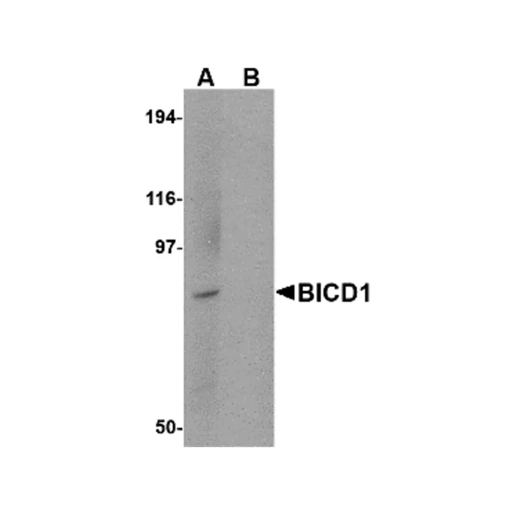 ProSci 4663 BICD1 Antibody, ProSci, 0.1 mg/Unit Primary Image