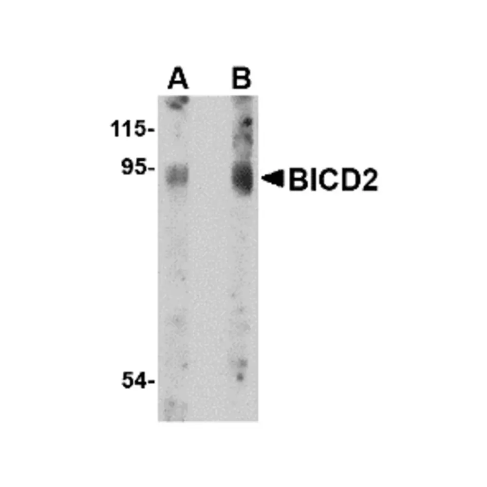 ProSci 4675 BICD2 Antibody, ProSci, 0.1 mg/Unit Primary Image