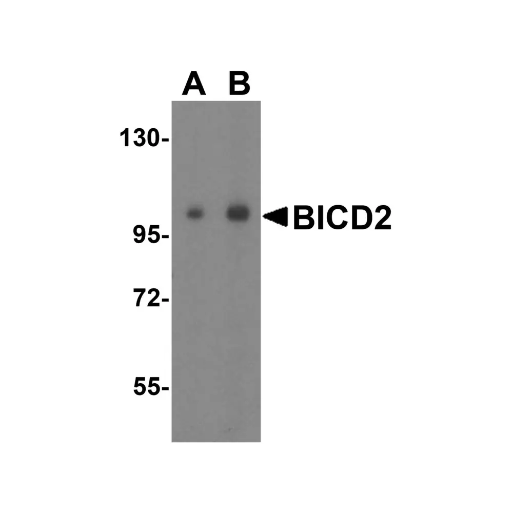 ProSci 4677 BICD2 Antibody, ProSci, 0.1 mg/Unit Primary Image