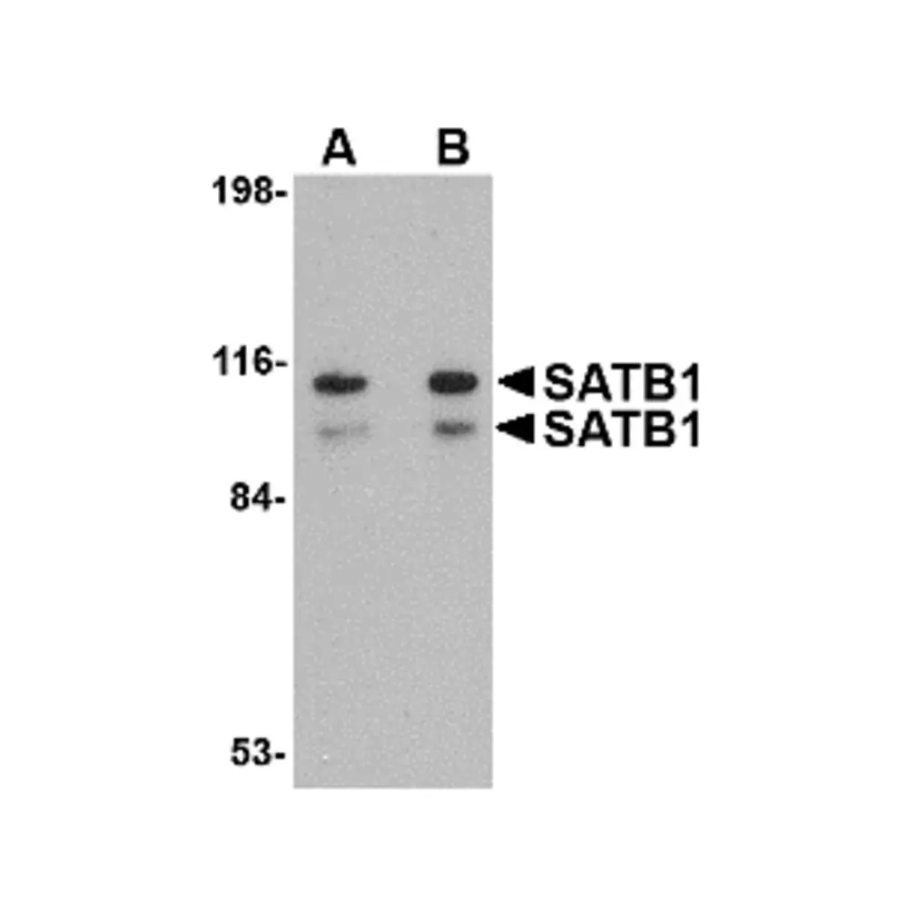 ProSci 4679_S SATB1 Antibody, ProSci, 0.02 mg/Unit Primary Image