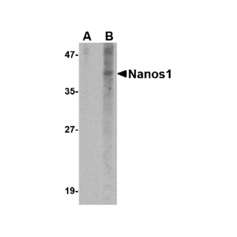 ProSci 4683 Nanos1 Antibody, ProSci, 0.1 mg/Unit Primary Image
