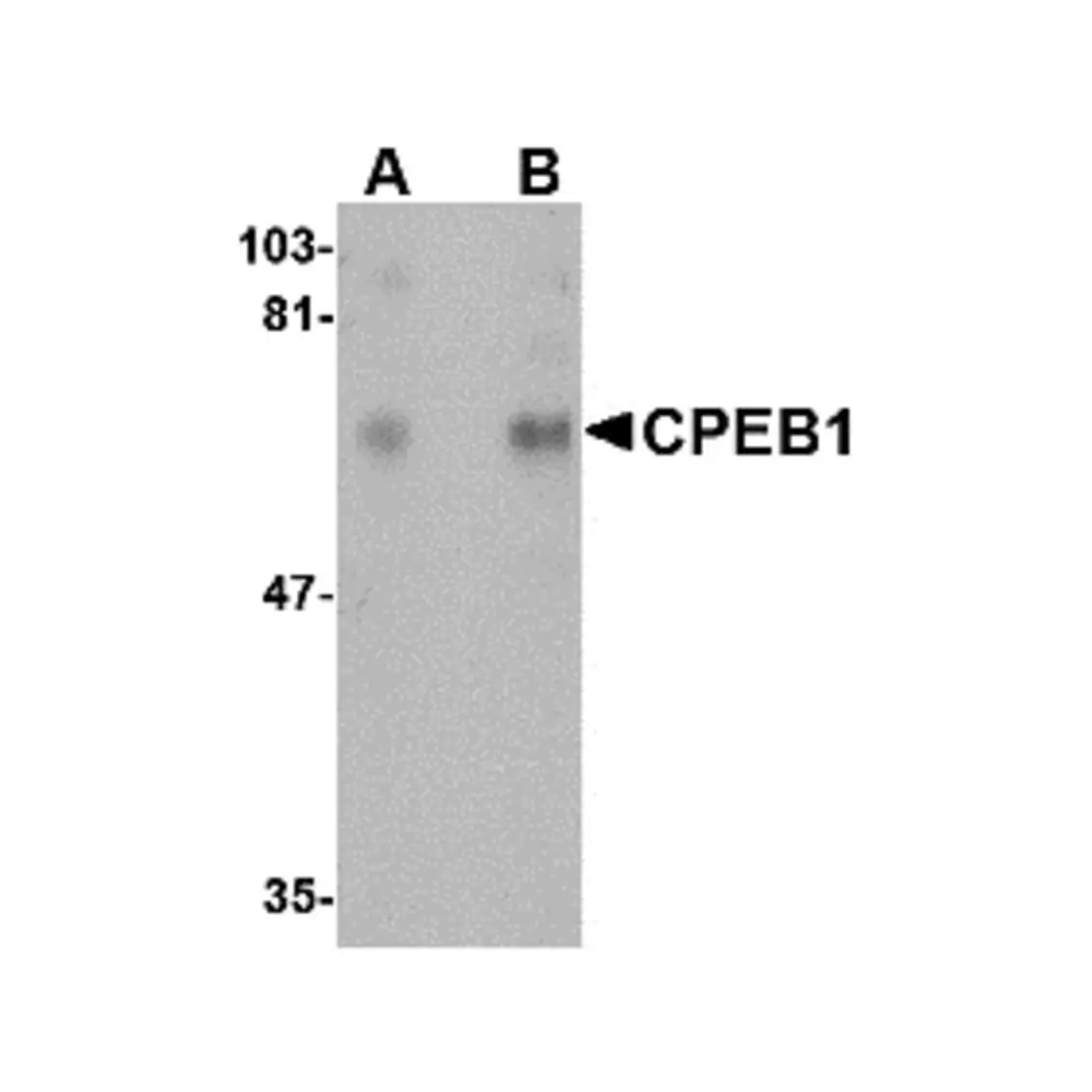 ProSci 4687_S CPEB1 Antibody, ProSci, 0.02 mg/Unit Primary Image