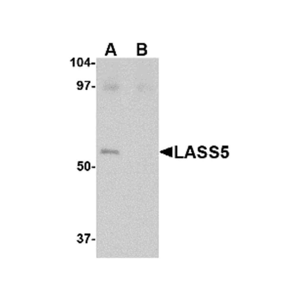 ProSci 4695_S LASS5 Antibody, ProSci, 0.02 mg/Unit Primary Image